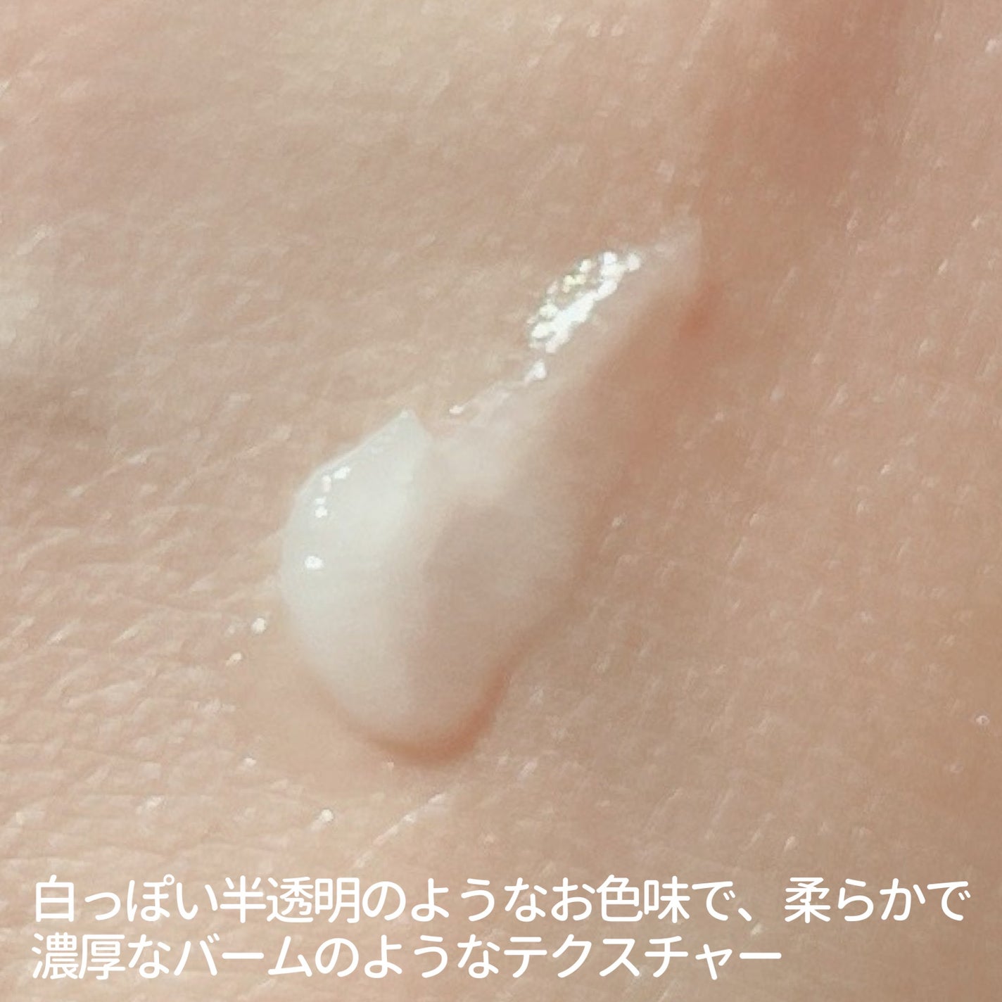 タカミリップ/タカミ/リップ美容液を使ったクチコミ(5枚目)