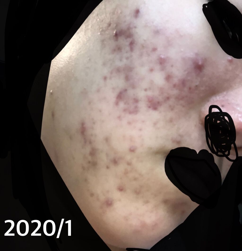 ハトムギ化粧水(ナチュリエ スキンコンディショナー R )/ナチュリエ/化粧水を使ったクチコミ(2枚目)