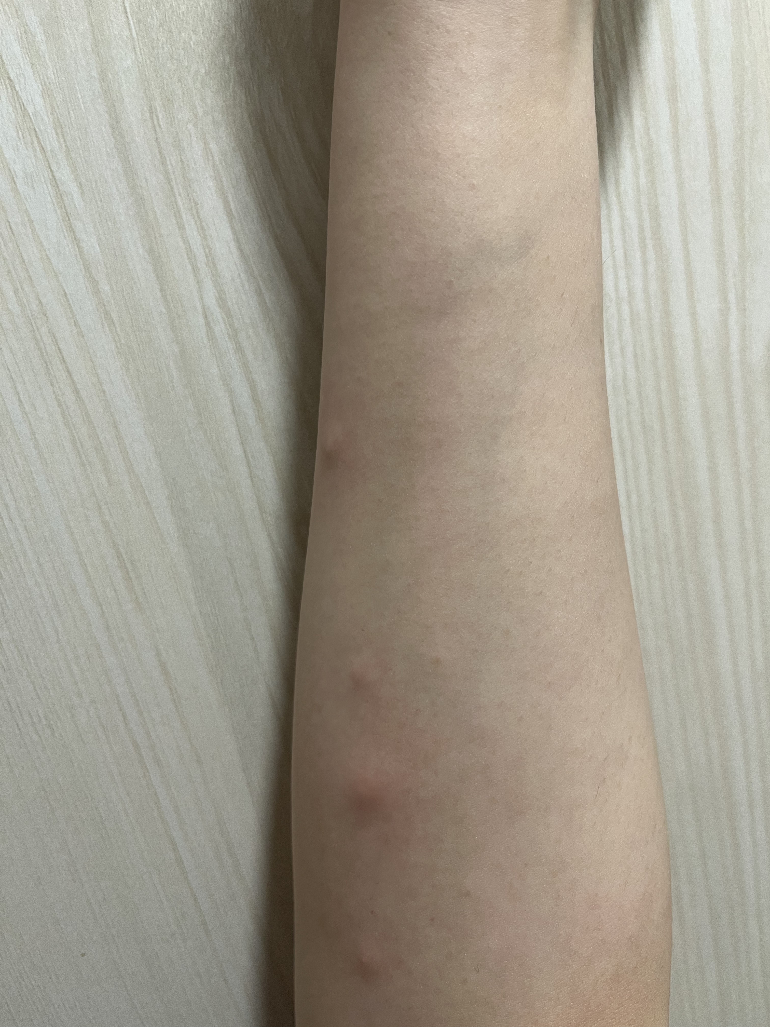 新ウナ コーワ クール(医薬品)/コーワ/その他を使ったクチコミ（3枚目）