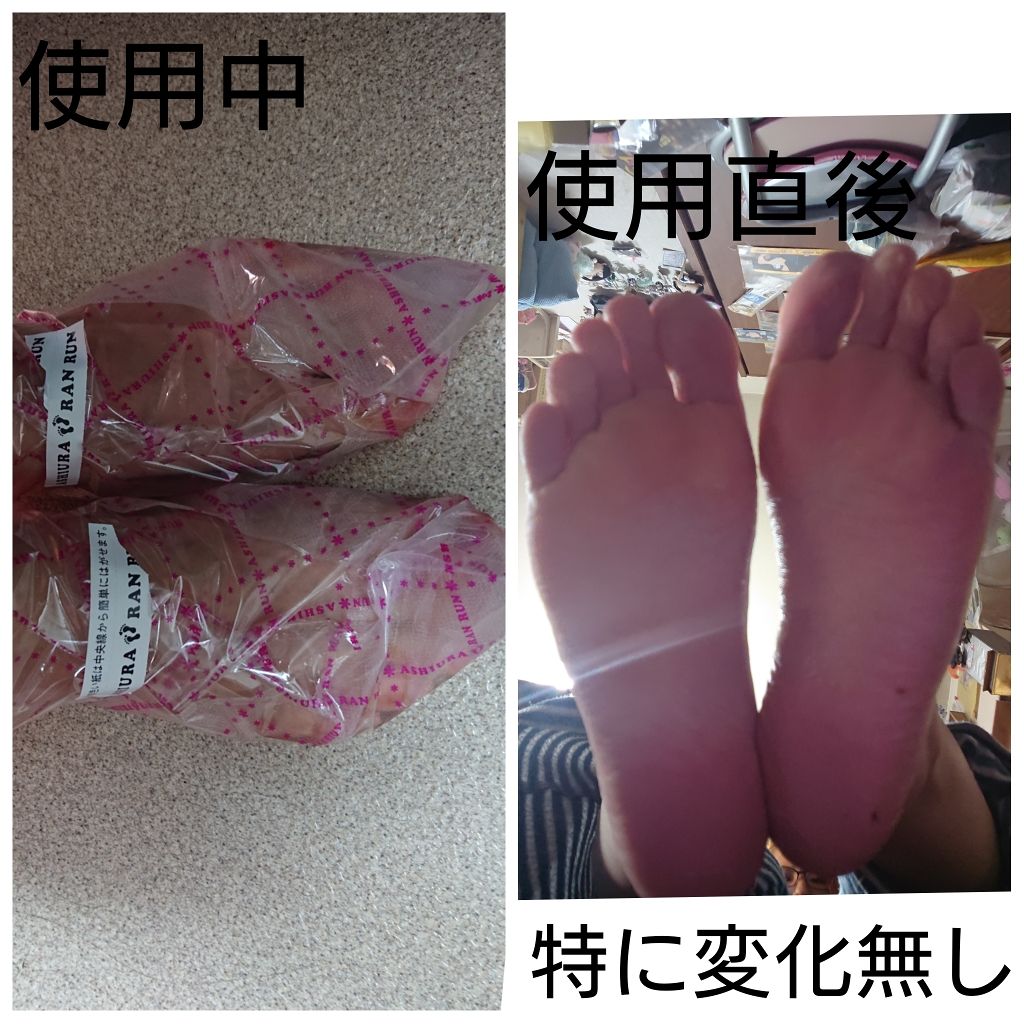 足裏ランラン エキスプレス｜MYMの口コミ「⚠️画像閲覧注意⚠️商品の使用上角質の画像..」 by シュガリー@♥爆撃????(普通肌/20代後半) |  LIPS