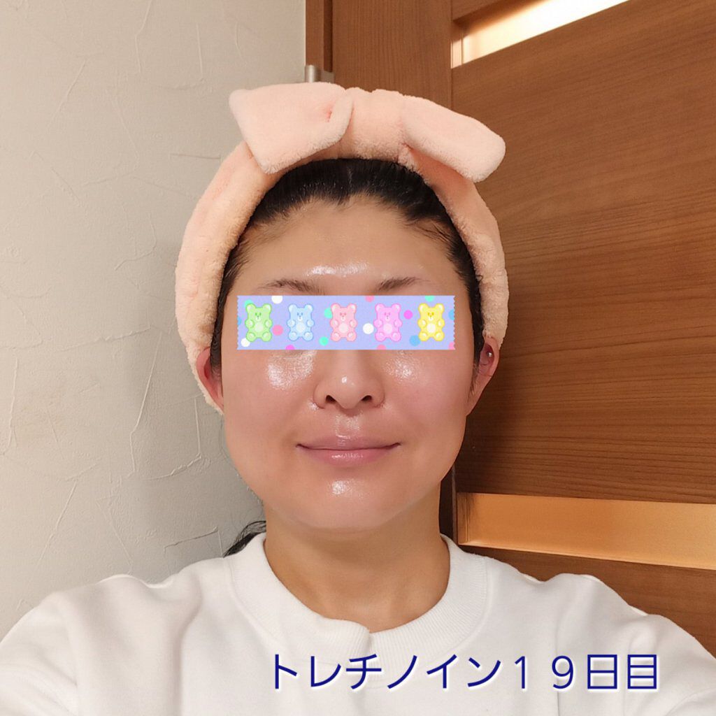 リンクルシートマスク Ｎ/なめらか本舗/シートマスク・パックを使ったクチコミ（1枚目）