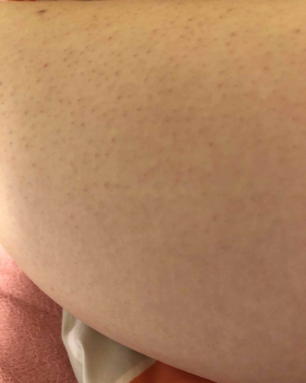 脱毛クリーム MOOMO/自然化粧品研究所/除毛クリームを使ったクチコミ(4枚目)