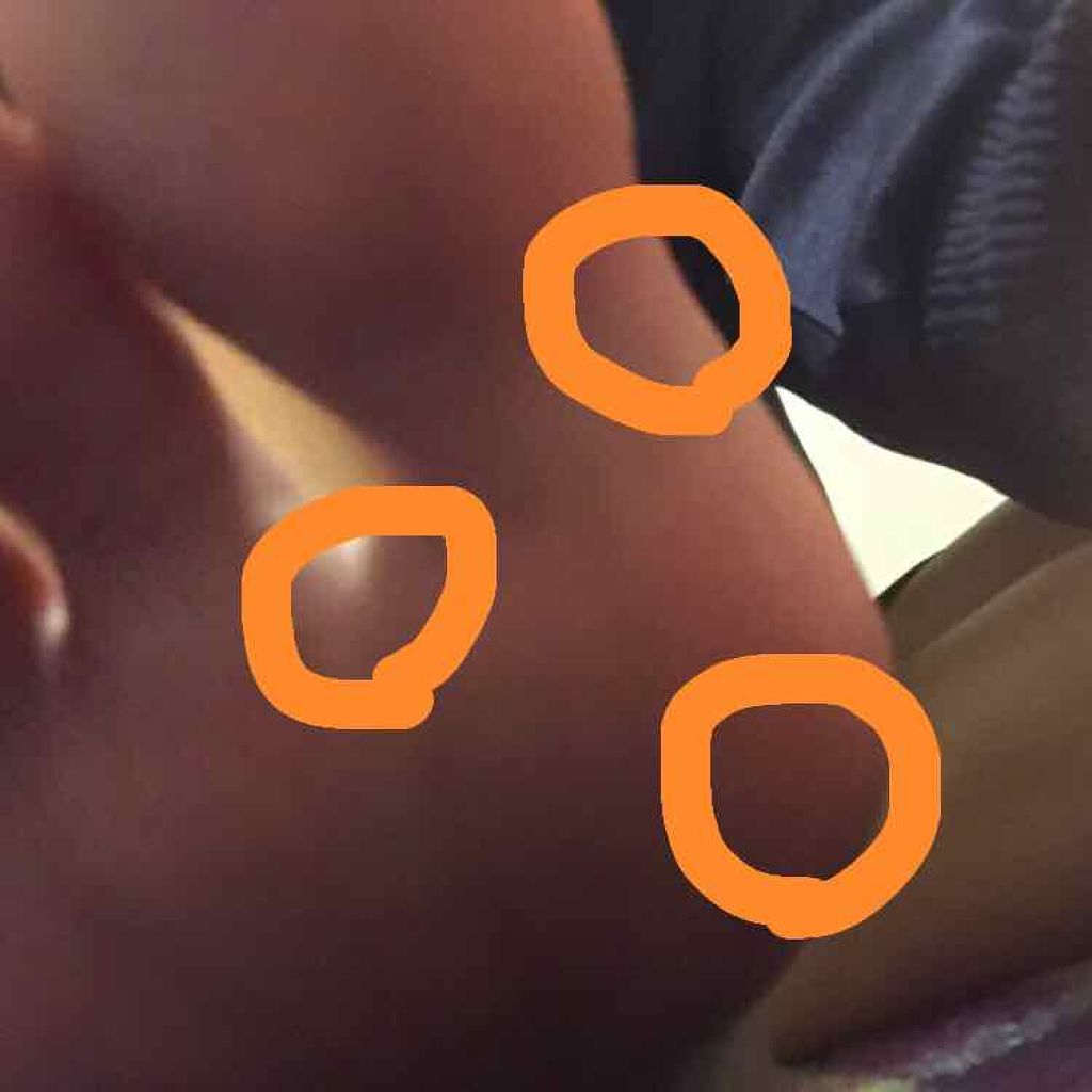 タコ・ウオノメ除去用/バンドエイド/ボディグッズを使ったクチコミ（2枚目）