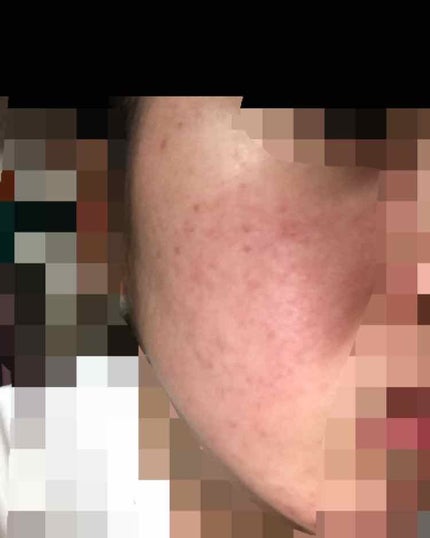 ベルブラン/あいび/美容液を使ったクチコミ(2枚目)