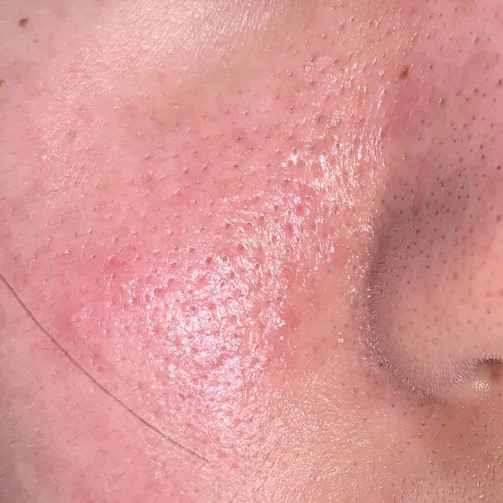 ハトムギ保湿ジェル(ナチュリエ スキンコンディショニングジェル)/ナチュリエ/美容液を使ったクチコミ（3枚目）