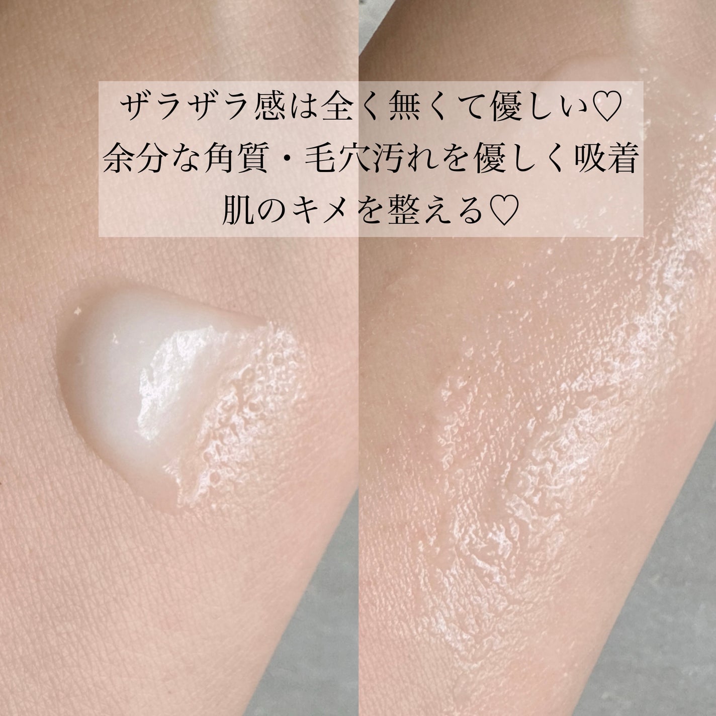 Lisaðââ¬æçš¿ãããã©ããð«¶ð» on LIPS ãäœåãªè§è³ªã»æ¯ç©Žæ±ãåªããåžçâ¡ããããããŠããŠãèãã£ãšãâ¡..ãïŒ3æç®ïŒ