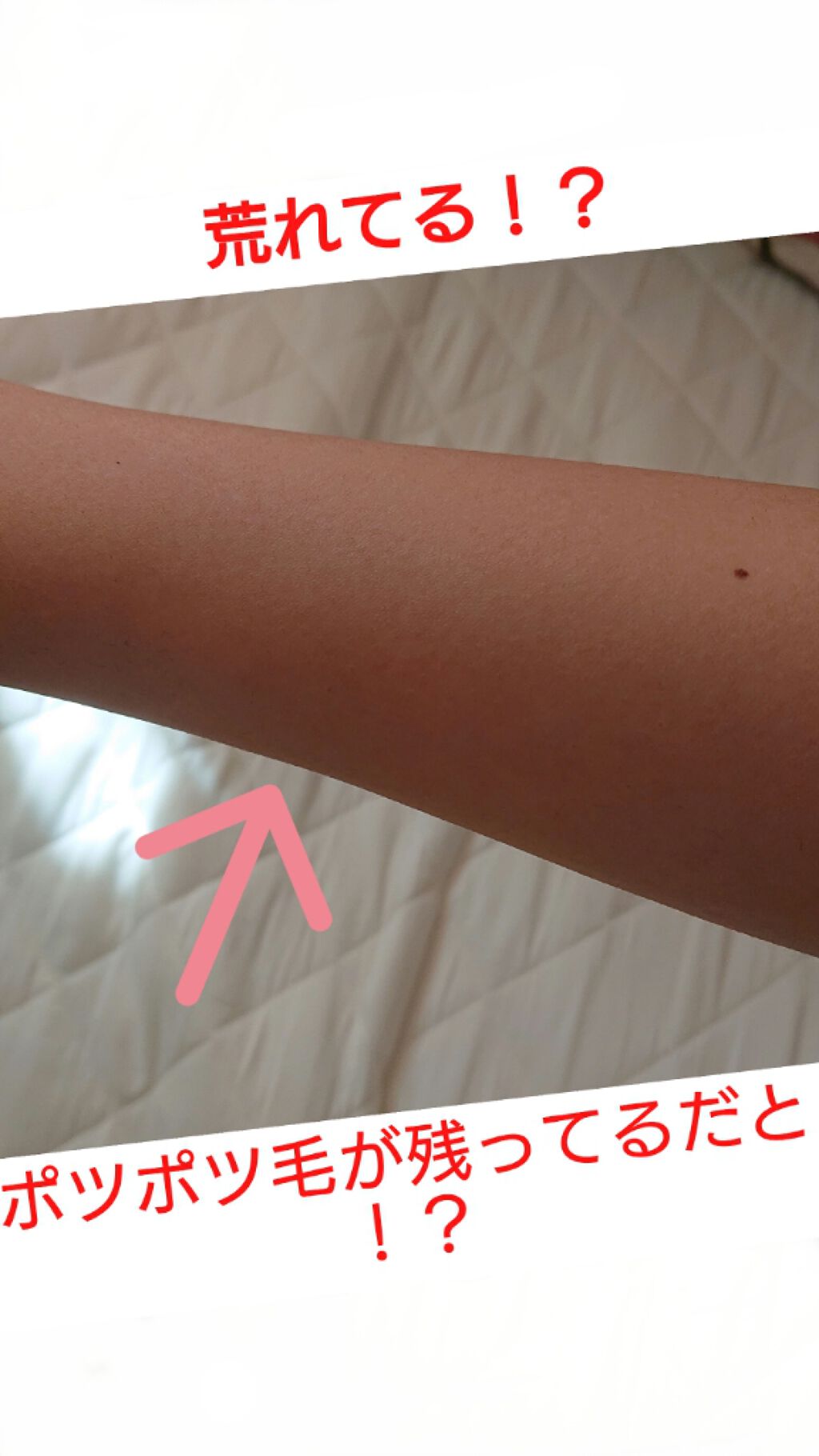 脱毛クリーム MOOMO/自然化粧品研究所/除毛クリームを使ったクチコミ(1枚目)