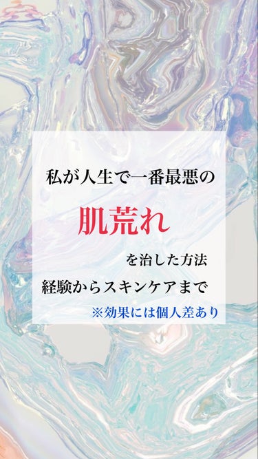 今回は私が人生で一番最悪の肌荒れを治した経験談と当時使っていたスキンケアを紹介していきます。文字がメインでかなり長文になってしまうので、時間がある時にゆっくり読んで頂けたらなと思います🙇‍♀️
実は私が肌荒れを起こしたのはかなり前の話で、何度も投稿しようとしたのですが上手くまとまらずに諦めていました。肌荒れにも様々な原因があって、紹介して合わなかった場合のリスクとかを考えてしまっていたのですが、肌荒れを起こした当時は正直、本当に急なことでものすごく焦ったし、鏡が嫌になるくらい自分の顔を見ることができなかったです。ですが、この肌荒れを引き起こしたことがきっかけでスキンケアにはかなり敏感になったので、今では良い経験だったと感じています。当時はネットで色んな方の経験や情報を調べたり試したりして、それで少しは救われたというか、頑張って治そうとするきっかけになったので、当時の私みたいに肌荒れで本当に悩んで不安になっている方のサポートに少しでもなれれば良いなと思って投稿しました。


まず、読んでいただく前に注意してもらいたい点が二つあります！
一つ目が私は忙しかったというのもあってなかなか皮膚科に行くことができませんでした。もちろん肌荒れを起こしたら自分であれこれやるよりも皮膚科に行くことを絶対におすすめします！ですが私は皮膚科には行かずに自分で治しました。
そして二つ目が、スキンケアには個人差があることを忘れないで欲しいです。今回紹介するスキンケアは私が実際に使って効果を感じたものであっておすすめはしますが、全員に効果があるというものでは無いです！そこの理解をお願いします‼︎🙇‍♀️肌荒れに悩んでいる方は不安で色々使ってみたくなる気持ちもわかりますが、自分に合わず逆により酷くなってしまうパターンもあります！私もいろいろ試して悪化したことがありました😣なので全て信じるのではなく、こんな人がいたんだなあくらいの軽い気持ちで読んでいただきたいです。肌荒れを治すには、肌に負担をかけないためにも、自分に合うスキンケアを慎重に、自分のペースで探していくのが本当に重要です！！！なので今すぐに治すのではなく、ゆっくりと長期的に治すことを意識してもらえると精神的にも楽になるかと思います☺️



ここから本題に入ります。

ー肌荒れを引き起こしたきっかけー
私は元々スキンケアの知識が浅く、お風呂から上がってハトムギ化粧水と無印の乳液を塗るくらいの本当に軽い保湿だけしていました。それだけでも特に肌荒れすることもなく生活していたんですが、コロナが流行ってマスク生活を送るようになってから、急に人生で初めてと言っていいほど、大量のニキビが頬からあごにかけてできてしまいました。赤ニキビだけでなく白ニキビもあり、全体的に赤く炎症しているような感じでした。皮膚科に行かなかったので、本当の原因がなんだったのかはわかりませんが、おそらくマスクによる蒸れや摩擦が原因だったと思います。その他にもストレスや食生活など様々な原因が重なってできてしまったと思います。当時の写真をみても合計で30個以上はありました。


ー肌荒れを治した方法ー
まず治すために全体的にスキンケアを変えました。
私のスキンケアの順番は、クレンジング→洗顔→化粧水→パック→美容液→乳液です。クリームはオイリーなのが苦手で、使うと油分が多かったのかニキビが悪化してしまったので当時は使っていませんでした。
まずクレンジングは化粧をしていない時でもするようになりました。化粧をしていなくても洗顔だけでは取りきれない毛穴汚れなどを取るためです！私はオイルが合っていたのでずっと使っていますが、ニキビ肌の方はミルクタイプなどが良いみたいです！毛穴の汚れや洗い上がりの感じが、オイルかもしくはバームじゃないと私は満足できないので、オイルクレンジングを使用しています。
洗顔は100均に売ってる泡立てネットを使って、モコモコの泡で肌を包むようにし、なるべく摩擦を減らすようにしました。あと洗顔はあまり長くしない方が良いみたいなので、泡で包み込んで小鼻などの気になる部分をクルクルしてなるべく早めに終わらせるようにしました。あとは終わった後タオルで拭いていたんですが、ティッシュかキッチンペーパーで抑えるように拭くようにしました。これはタオルについた雑菌を肌につけないようにするためです！最近はクレンジングティッシュもあるのでそちらをおすすめします！
そして拭き取り化粧水を始めました。以前は洗顔が終わったらすぐ化粧水を塗っていたんですが、実はクレンジングして洗顔しても取れていない汚れがあったりします。その残った汚れが肌荒れの大きな原因になるので顔についた汚れをしっかりキレイに取ってから、保湿してあげることが重要だと気づきました。拭き取り化粧水は市販で拭き取り化粧水として売っているものでもトナーパッドでもお手持ちの化粧水をコットンに浸したものでも、次のスキンケアにひびかなければ私は正直なんでも良いと思います👍
化粧水は手で浸透させるのが好きなので、最低でも3回は重ねてつけていました。何度も重ねて使うことで肌の奥まで浸透して、長時間乾燥しづらい肌になります。目安は肌が鏡に手で触れた時と同じくらいの冷たさになるくらいまで化粧水を入れます。また、手で肌を抑えた時に、少し吸い付くくらいがベストです！
次はパックをします。これが重要です！ニキビは炎症している状態なので赤く熱を持っています。お風呂上がりは特に乾燥しやすく、肌が熱を持ちやすいです。なので肌の温度を下げてあげることで鎮静されて、炎症も和らぎます。安いパックでも良いので毎日パックをして肌の熱を下げることで乾燥も防げるし、炎症しづらい肌になります。私はティーツリーやシカ成分が含まれているものをよく使っていました。
美容液も手で塗ります。最初は美容液って量も少ないし高くて使うと少し勿体無いなと感じていたのですが、ここでケチると本領を発揮できないので、しっかりと十分な量をとって使用します！乾燥しやすい部分は入念に！私は使い心地が軽いジェルタイプの美容液を使用していました。
最後に乳液を塗ります。私はフェイスラインが乾燥しやすいので重点的に塗っています。ここであまりオイリーすぎるものを選んでしまうとニキビができやすくなることもあるので、使用感や効果など自分に合った乳液選びが重要です。ただ乾燥が原因でニキビができることもあります。スキンケアのフタの役割をしてくれるのでベタベタするから使わないのではなく、乳液かクリームは塗ることをおすすめします。気になるようでしたらジェルなどもおすすめです！


ー実際に使用していた製品ー
⚪︎クレンジング
ソフティモ　スピーディ　クレンジングオイル
私がずっと何年も愛用しているクレンジングで、本当に安いのにメイクがよく落ちるし、洗い上がりがツルッとしているので気に入ってます！摩擦を減らすためにも、安くてもいいから一回で大量に使えるのがおすすめです！

⚪︎洗顔
SENKA パーフェクトホイップ
泡立ちが良くて、濃密でモコモコの泡が少量でもできるからコスパも良いし、刺激もなく洗い上がりもつっぱらずに使える！私は泡立ちが良いから使っていたけど、ニキビ肌用の洗顔や牛乳石鹸などもおすすめです！

⚪︎化粧水
ビオデルマ　イドラビオEローション
この化粧水は本当におすすめ！！高いけど確かに効果があって、ニキビに悩んでた私の肌の救世主になってくれました。香りがあるんですけど石鹸みたいな香りで私は好きだったし、保湿力が高いのに水みたいなテクスチャでパシャパシャ重ねてつけられるところもおすすめです。肌に浸透していくのがよくわかる化粧水だったし、肌の水分量が上がってこれを使うと日に日に良くなっていくのが目に見えて実感できました。私はこの化粧水が合っていたのか、かなりこの化粧水でニキビが改善したので、試してみる価値はあると思います！！合計で3本くらい使い切りました。今は使っていないんですが、また機会があれば使いたいなと思うくらい本当に気に入って使っていたので、肌で悩んでいる方に是非使ってもらいたいです。私の肌荒れ改善スキンケアでもこの存在が一番大きくて、一番おすすめです！

⚪︎パック
メディヒール　ティーツリーマスク
このパックは有名で知っている方も多いと思うんですが、私はニキビが炎症して肌が熱くなったり、ヒリヒリしている時は無理にスキンケアせずに、パックに頼ることが多かったです。このパックは低刺激で肌の鎮静効果が期待できるので、保湿力もあり本当に助けられました。肌の温度が下がって炎症が落ち着くのも一番実感できたパックだったし、常にストックしてありました。鎮静系のパックでシートも薄くてちゃんと密着するので乾燥することなく使えて、肌荒れしてる時に一番使いやすいパックだなと感じたのでおすすめです！

⚪︎美容液
ビオデルマ　イドラビオセラム
この美容液は化粧水が良かったので買ってみたものだったんですけど、美容液では珍しいジェルタイプのものでポンプ式になっているので衛生的にも使いやすくて良かったです。ジェルというのもあり正直保湿力はそこまで期待できないけど、他の製品に比べてベタつきが少なく、さっぱりとしてるけど水分量を上げてくれる感じでぷるぷるになるので、化粧水とプラスして使うとより効果を実感できた気がしました。

⚪︎乳液
無印良品　乳液敏感肌用しっとりタイプ
私は無印良品の化粧水が合わなくて肌荒れしてしまったんですけど、乳液はわりと肌に合っていて、使い心地がしっとりもさっぱりもしすぎず、丁度良いので使いやすくて気に入っています。低刺激で肌に優しく、気持ちよく使えるので、シンプルかつ万能で優秀な乳液だと思います。私は特に肌荒れを起こさなかったので使い心地が好きな無印のしっとりタイプの乳液を使っていました！




ー肌荒れ改善スキンケアをするようになってからー
このスキンケアに変えてから、だいぶ肌の調子が良くなりました。以前が保湿しなさすぎるというのも関係してるとは思いますが、しっかりと汚れを落としてから清潔な状態で保湿をしてあげるというのがどれだけ重要かを実感しました。メイクしていると意外と落としきれていない汚れがあったりして蓄積されると毛穴が詰まってニキビができたりするので、そこを意識するだけでもだいぶ変わると思います。まとめると私は汚れをしっかり落として清潔な状態を保つ、摩擦をなるべく減らす、化粧水やパック、美容液で肌の水分量を上げてあげることで改善に繋がったと感じています。まだニキビ跡が少し残っていますが、ニキビが30個以上あったとは思えない肌になったと自分でも思うくらい綺麗になりました笑嬉しいことに肌が綺麗と褒められることも多くなって、ちゃんとスキンケアするようになるとオイリーじゃなくて、肌の透明感が上がって綺麗なツヤが出るようになるので、スキンケアで変われると本当に思います‼︎私もまだまだニキビ跡を治すために努力したいし、肌荒れに悩んでたからこその辛さがあったので、これからもスキンケア頑張ろうと思います！この投稿が少しでも肌荒れに悩んでいる方の力になれば嬉しいなと思います！長期的に継続することで絶対に変わるので一緒に頑張りましょう！💪


最後までみてくださりありがとうございました😊


の画像 その0