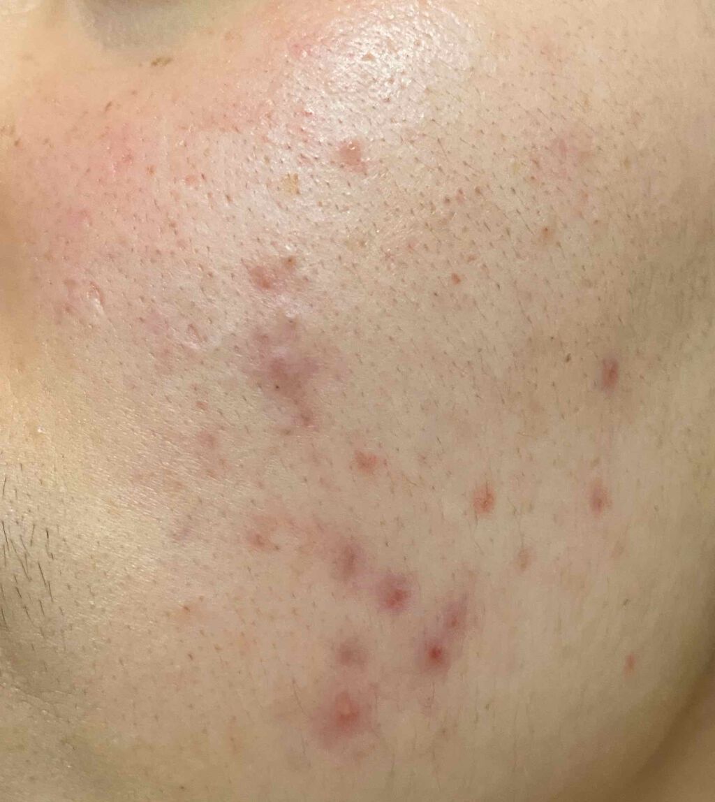 DETクリア ブライト&ピール フルーツ酵素パウダーウォッシュ/Detclear/洗顔パウダーを使ったクチコミ（3枚目）