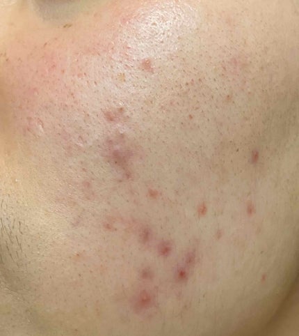 Cセラム/b.glen/美容液を使ったクチコミ(3枚目)