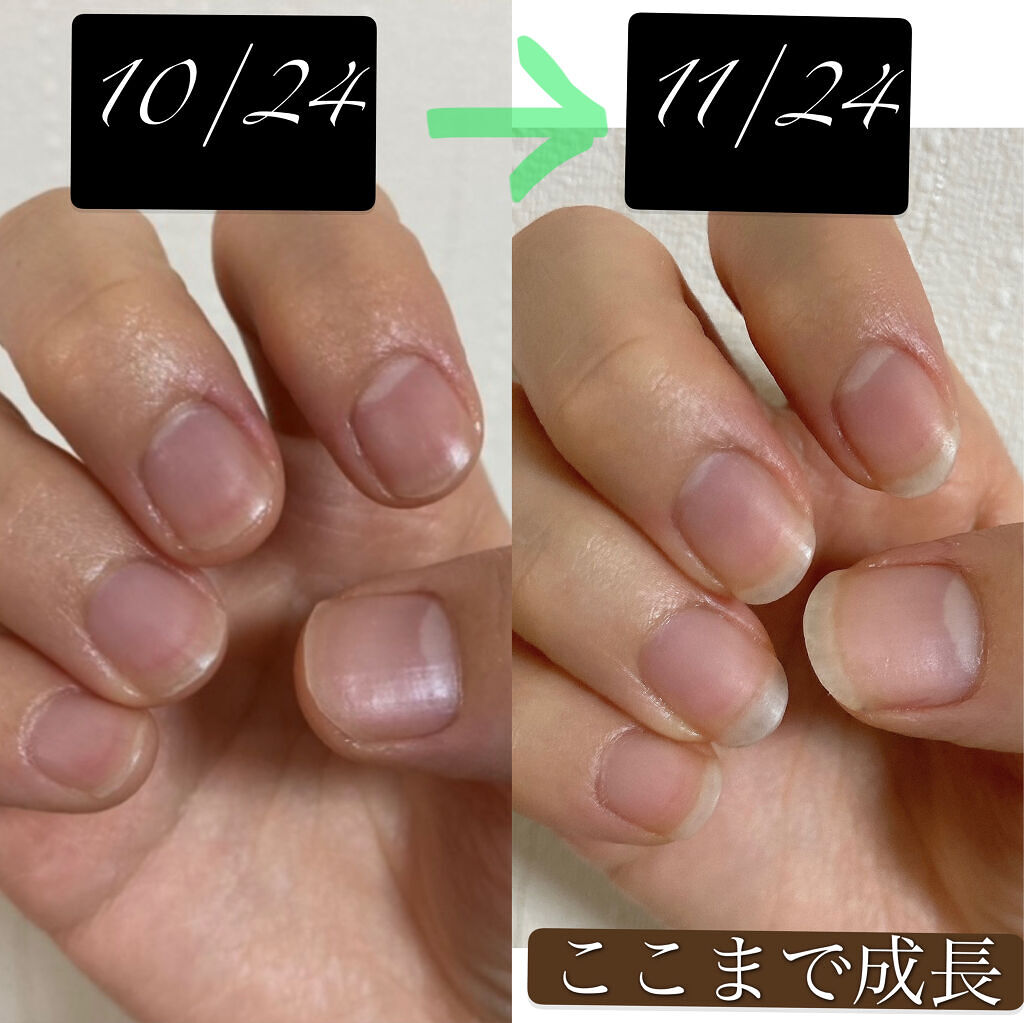 電動ネイルケア/DAISO/ネイル用品を使ったクチコミ（3枚目）