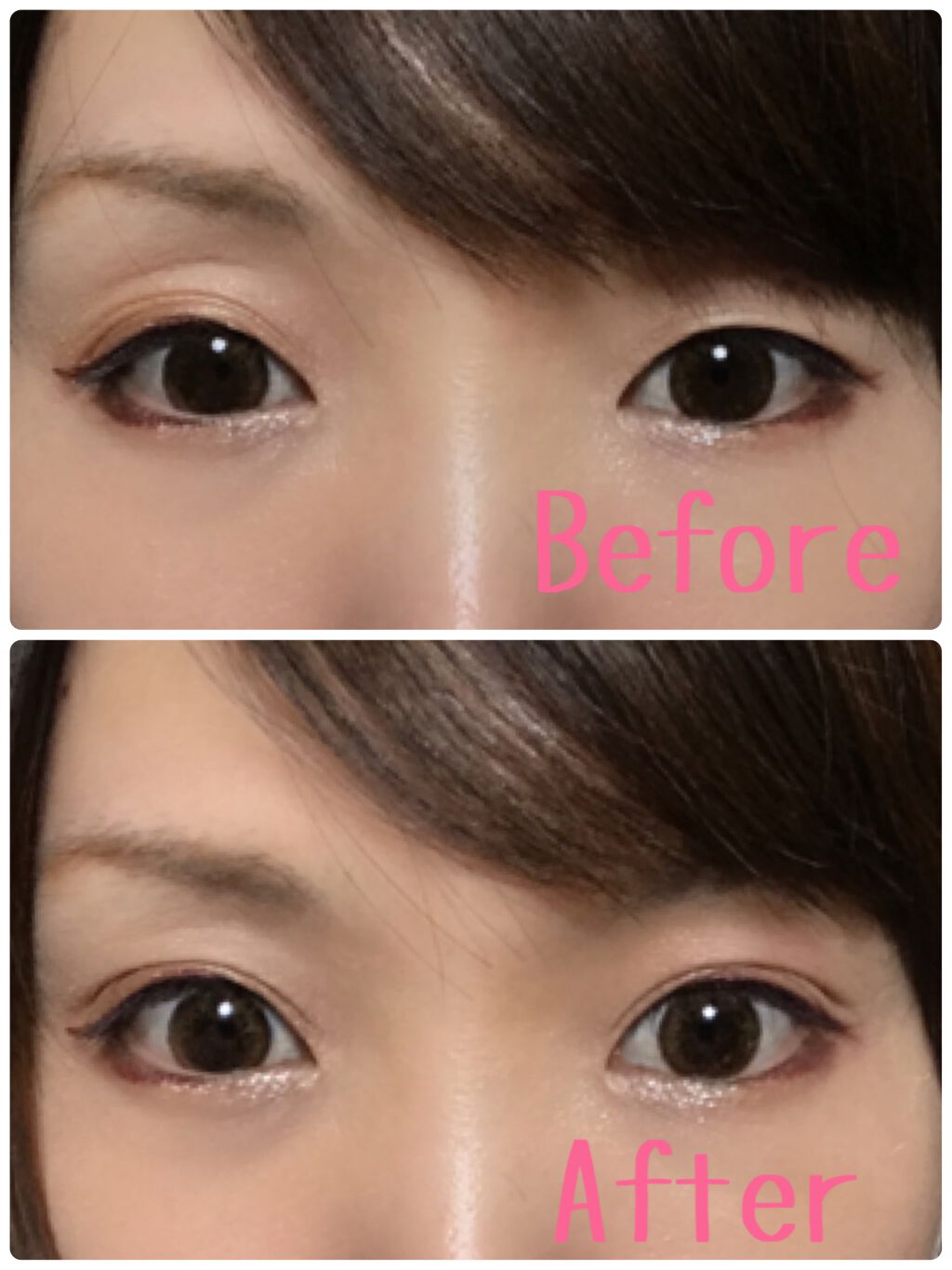 ワンダーアイリッドテープ Extra/D-UP/二重まぶた用アイテムを使ったクチコミ(1枚目)