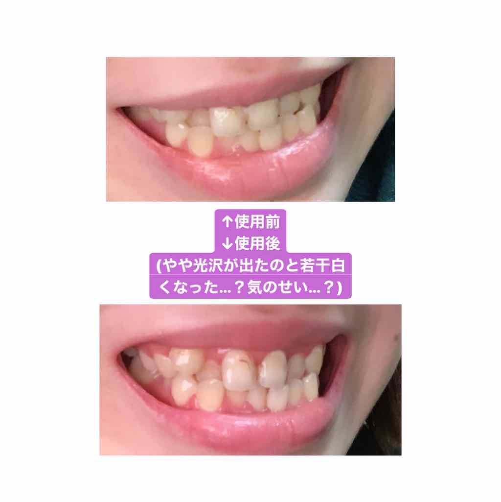 プレミアム クレンジングペースト/オーラツー/歯磨き粉を使ったクチコミ(2枚目)