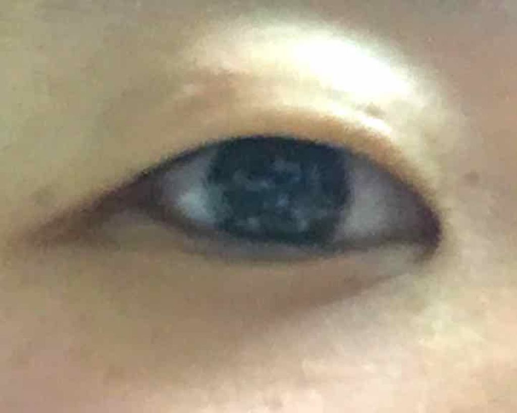 アイビューティー フィクサー WP/アストレア ヴィルゴ/二重まぶた用アイテムを使ったクチコミ（2枚目）