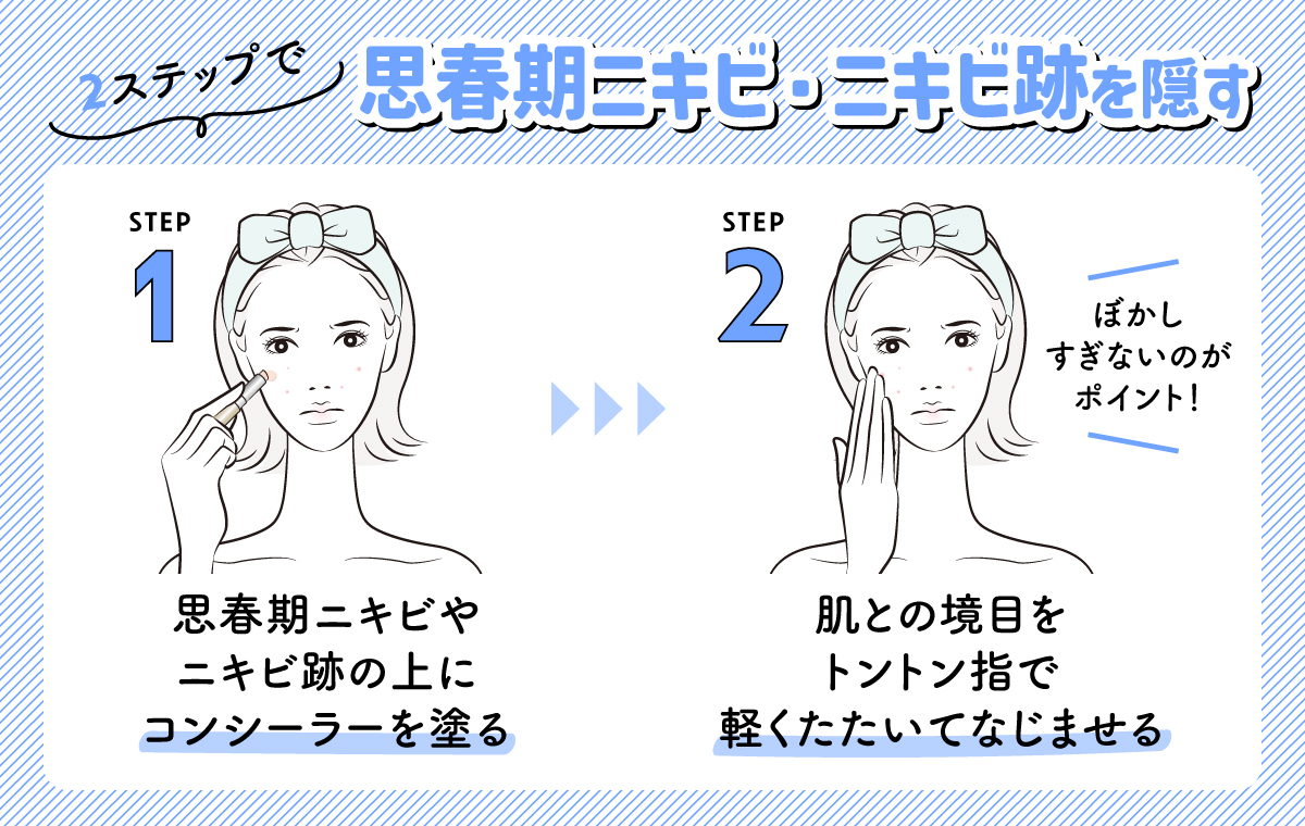 2ステップで思春期ニキビ・ニキビ跡を隠す方法は、思春期ニキビやニキビ跡の上にコンシーラーを塗せ肌との境目をトントン指で軽くたたいてなじませる。
