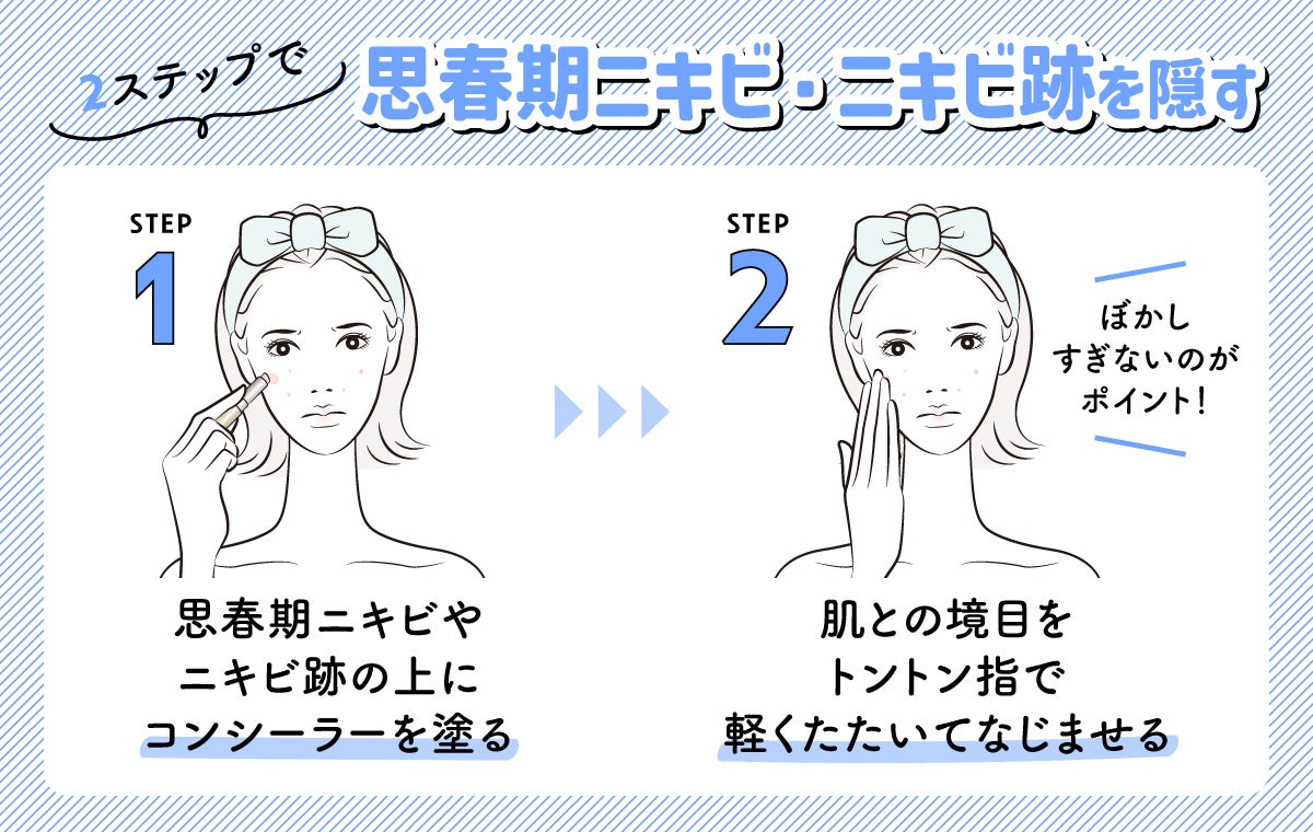 2ステップで思春期ニキビ・ニキビ跡を隠す方法は、思春期ニキビやニキビ跡の上にコンシーラーを塗せ肌との境目をトントン指で軽くたたいてなじませる。
