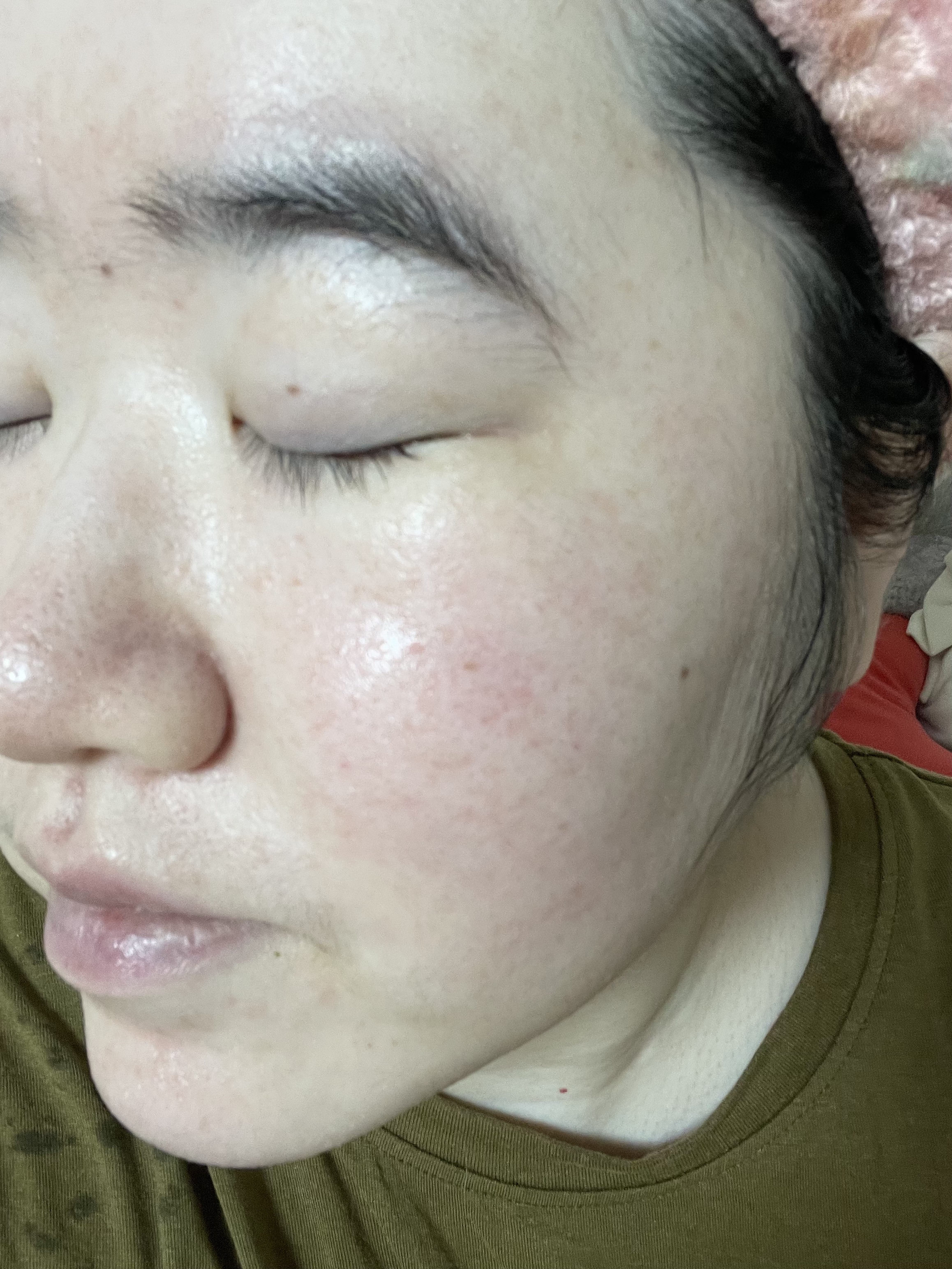 バイオームビタCグローデイリーシートマスク/UIQ/シートマスク・パックを使ったクチコミ（3枚目）