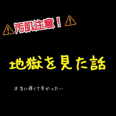 ハトムギ化粧水(ナチュリエ スキンコンディショナー R )/ナチュリエ/化粧水を使ったクチコミ（1枚目）