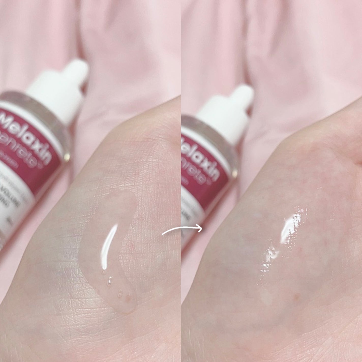 Cemenrete Calcium Intense Ampoule/Dr.Melaxin/美容液を使ったクチコミ(3枚目)