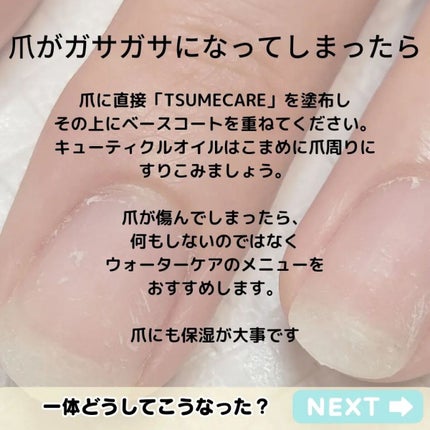 TSUMECARE/NailSalon mayunail/ネイルオイル・トリートメントを使ったクチコミ(8枚目)