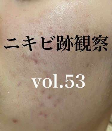 敏感肌用薬用美白美容液/無印良品/美容液を使ったクチコミ（1枚目）