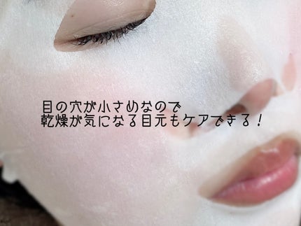 ルルルン ハイドラ V マスク/ルルルン/シートマスク・パックを使ったクチコミ(4枚目)