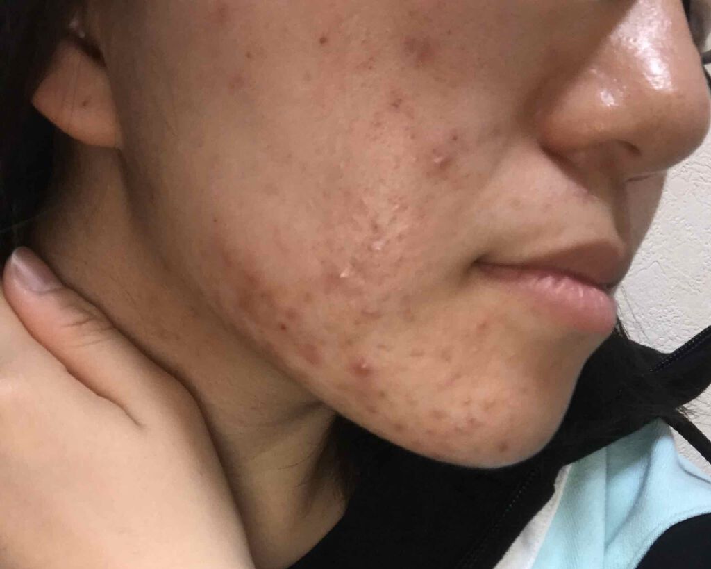 ゼロ毛穴パッド/MEDICUBE/ブースター・導入液を使ったクチコミ(2枚目)