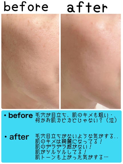 ハニーマスク/I'm from/洗い流すパック・マスクを使ったクチコミ(4枚目)