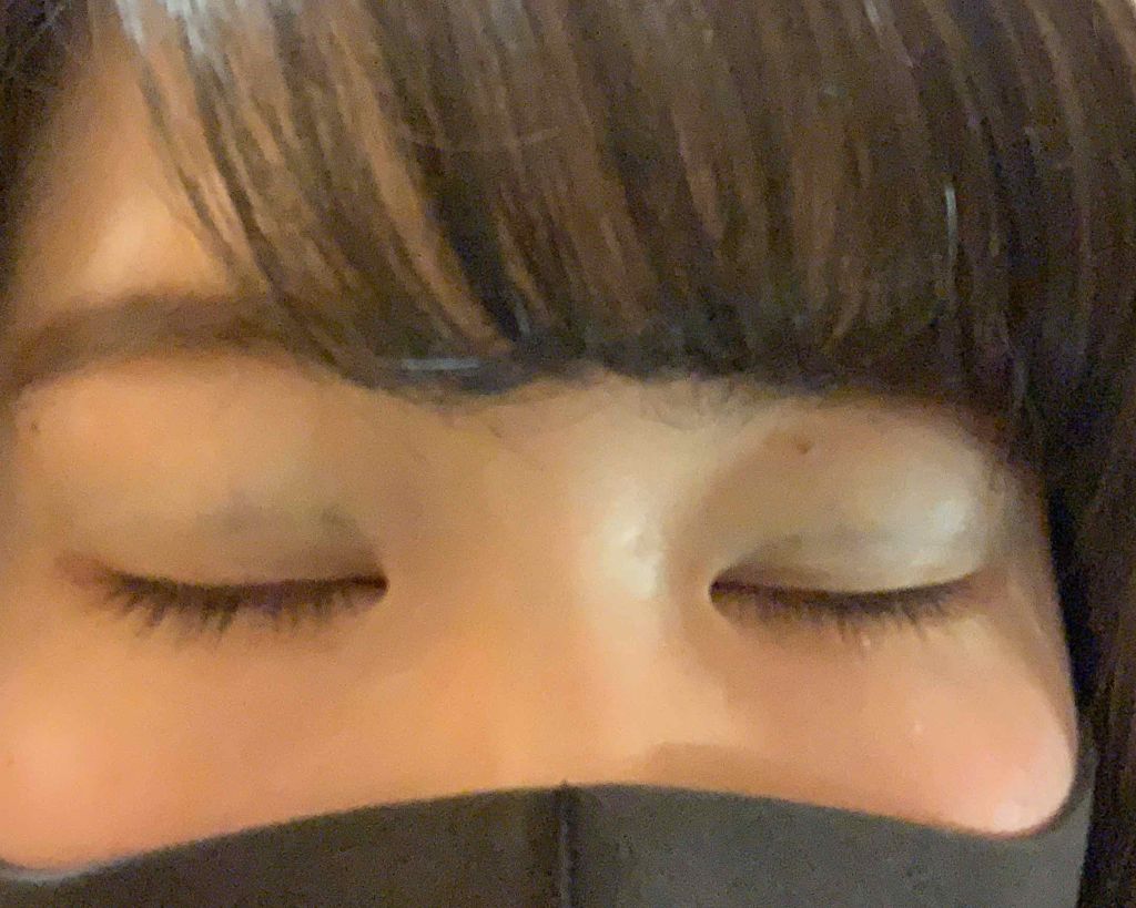 Yü on LIPS 「✾二重整形について(埋没)✾🦄私の二重について私は小6から二重..」(4枚目)