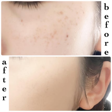 V3 ブリリアント ファンデーション/SPICARE/クッションファンデーションを使ったクチコミ(8枚目)