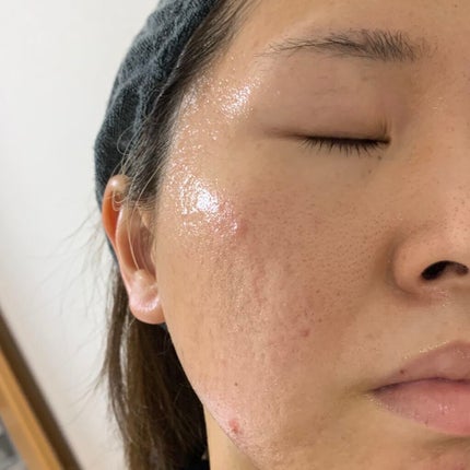 セルセラリターンアンプル/WONJIN EFFECT/美容液を使ったクチコミ(3枚目)