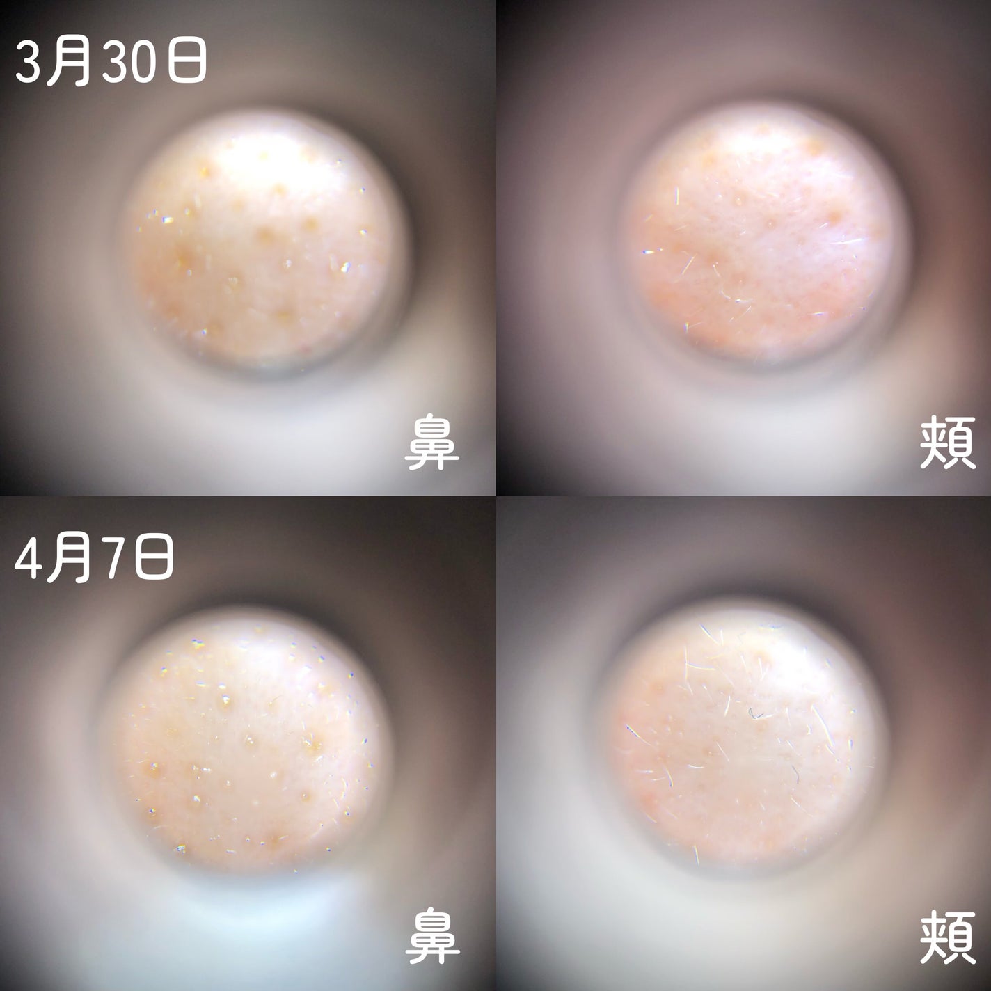 プロCICAリードルショット100/VT/ブースター・導入液を使ったクチコミ(4枚目)