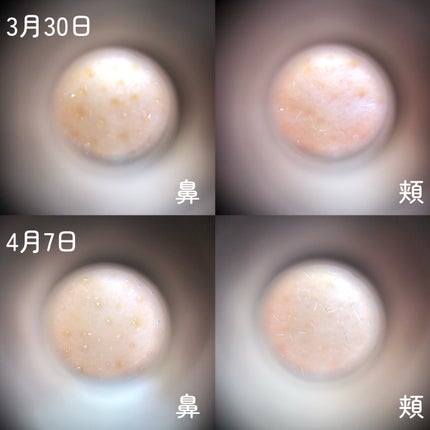 プロCICAリードルショット100/VT/ブースター・導入液を使ったクチコミ(4枚目)