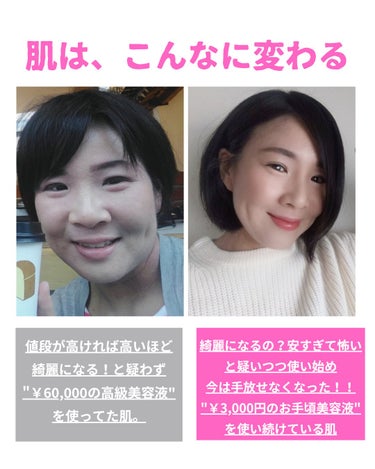 美肌カウンセラー💆綺麗のお助け相談所 on LIPS 「肌を綺麗にする専門家🚽美容きの旅人✈️肌はいつからでも何歳から..」（1枚目）