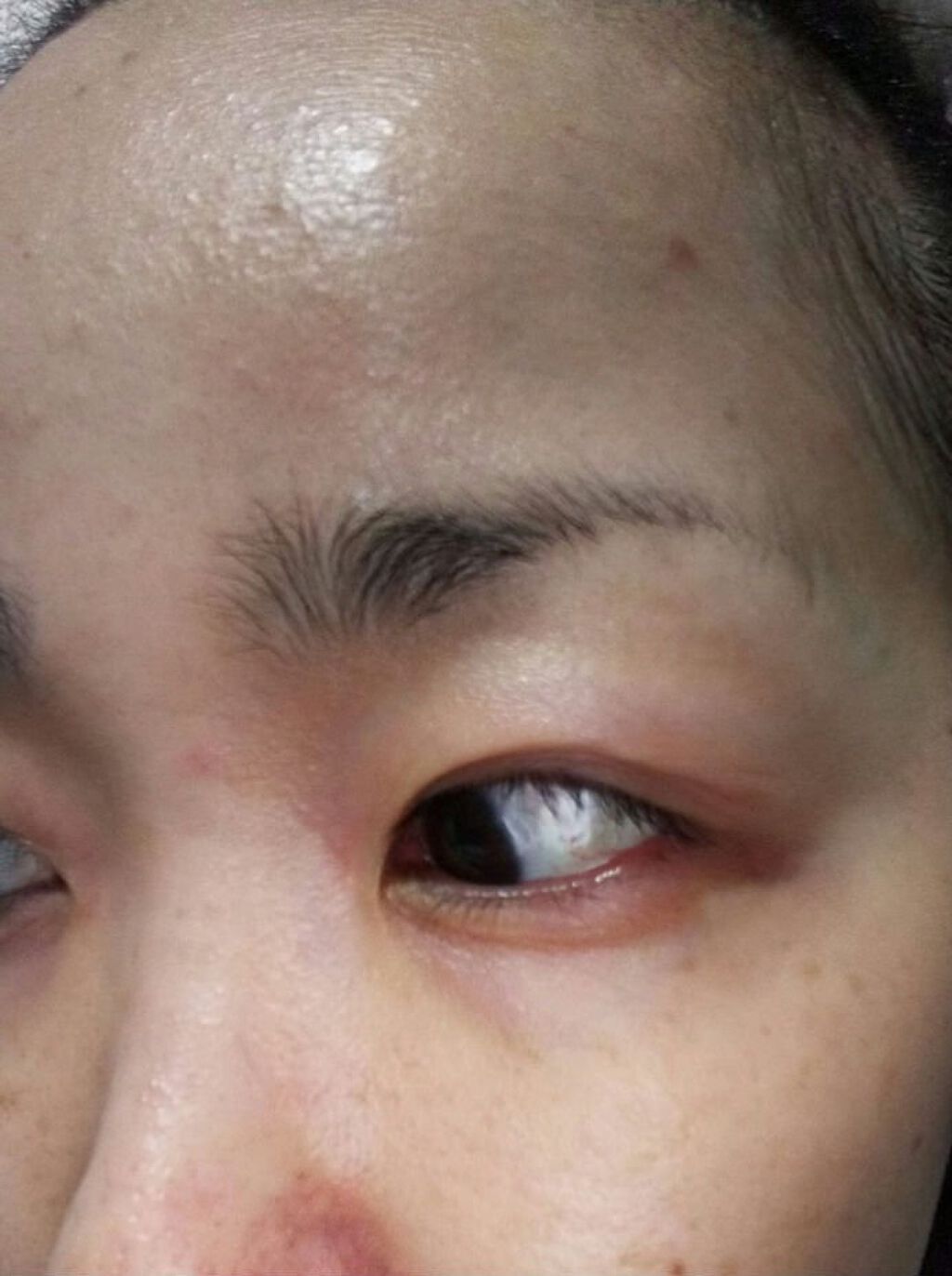 CICA マイルドトナーパッド/VT/トナーパッドを使ったクチコミ(2枚目)