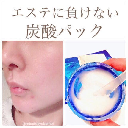 炭酸パック プルリ/ウツクシア/洗い流すパック・マスクを使ったクチコミ(1枚目)
