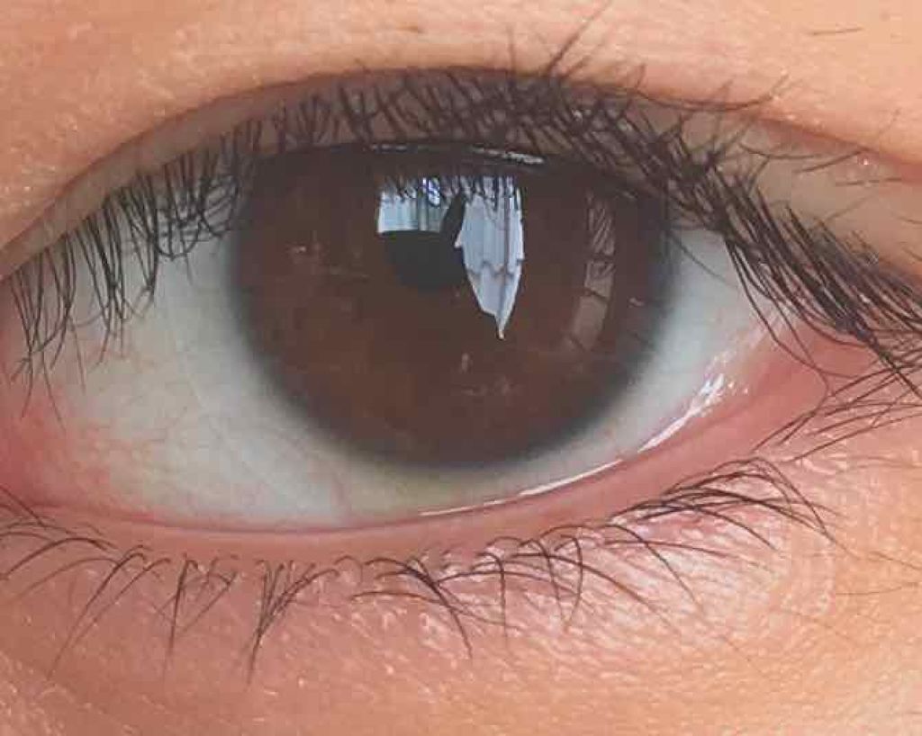 のびーるアイテープ(絆創膏タイプ、レギュラー)/DAISO/二重まぶた用アイテムを使ったクチコミ(2枚目)