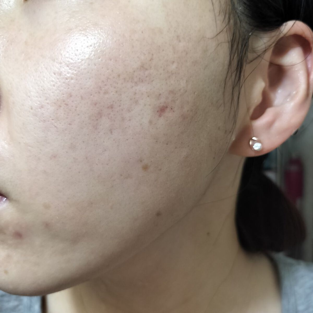 レチノールA 1% アドバンスドリバイタリゼーションクリーム/Life-flo/フェイスクリームを使ったクチコミ（2枚目）