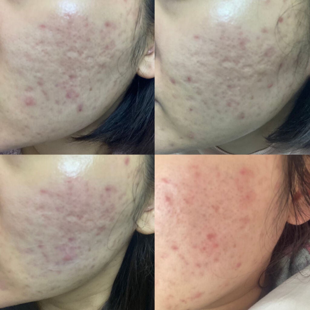 ザ・タイムR アクア/IPSA/化粧水を使ったクチコミ(3枚目)