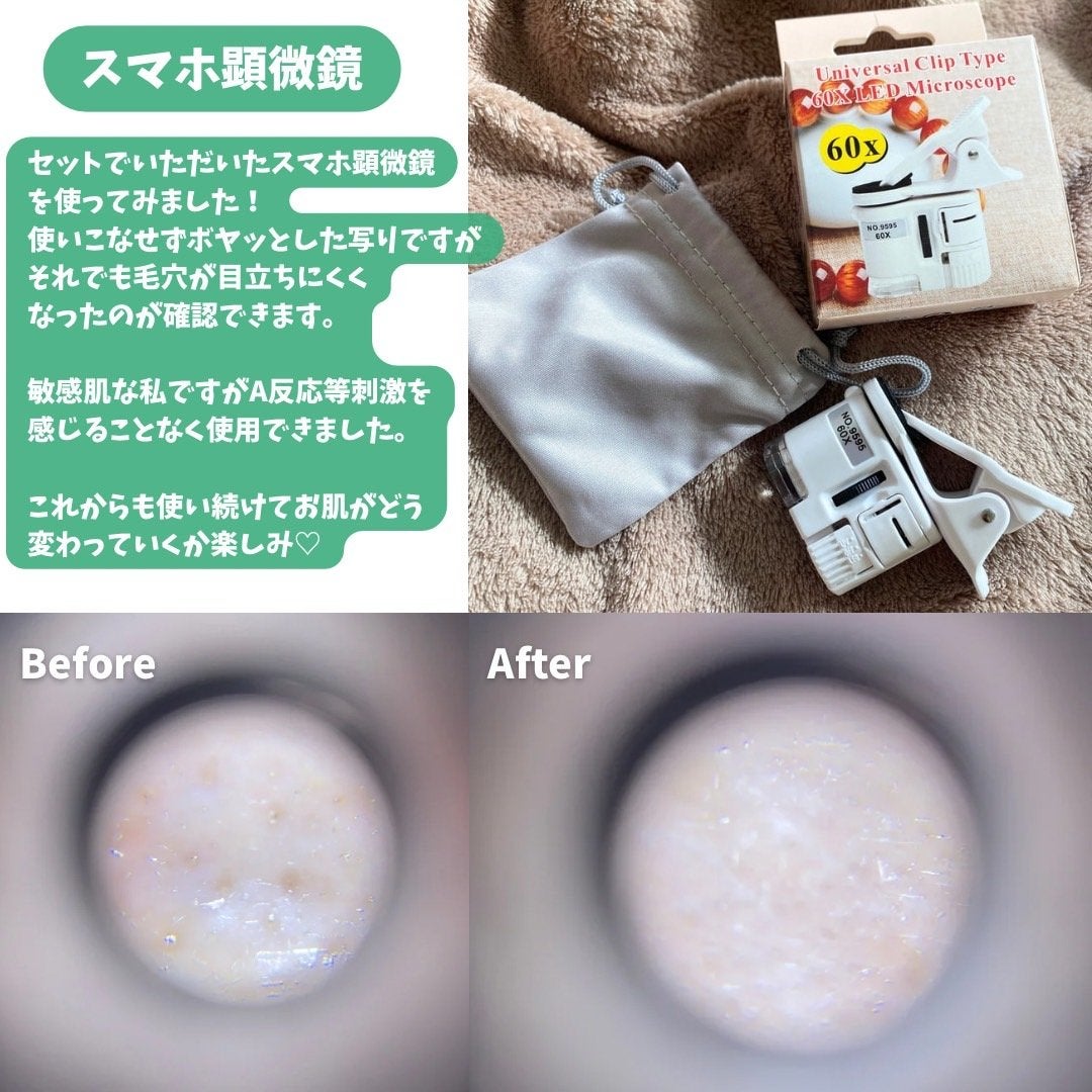 シカレチA エッセンス0.1/VT/美容液を使ったクチコミ(4枚目)