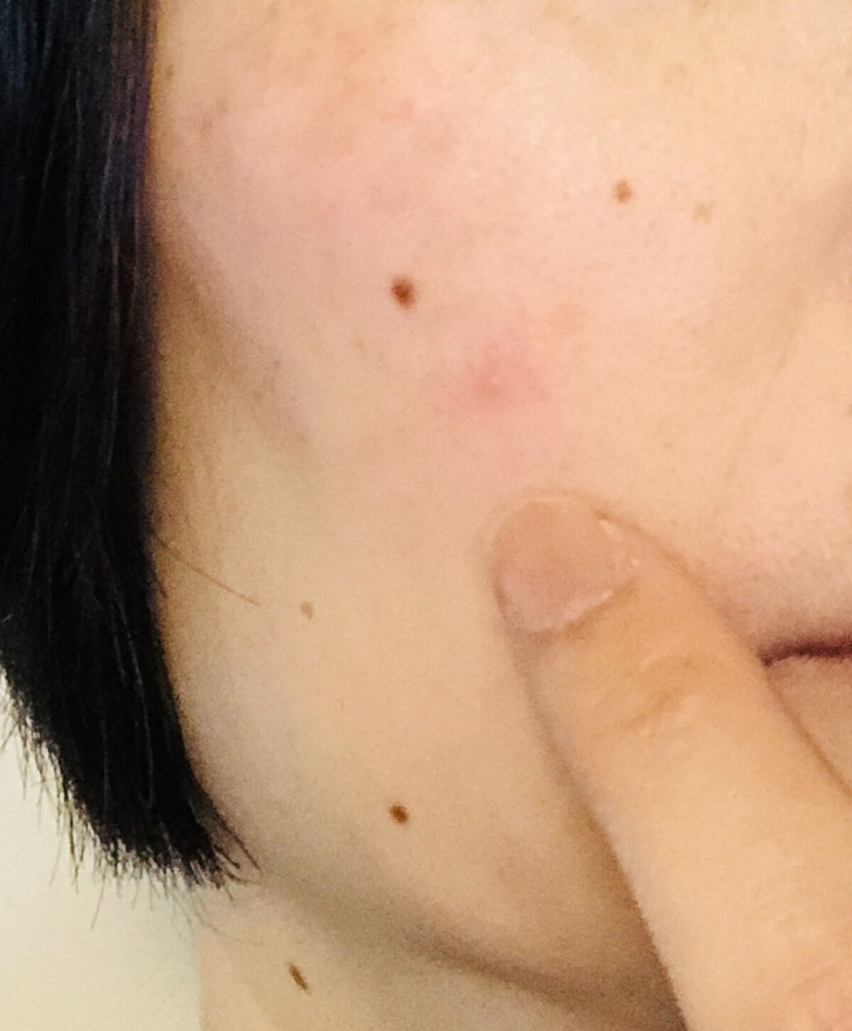 マジックティーツリーオイル/ブラン/フェイスオイルを使ったクチコミ（3枚目）