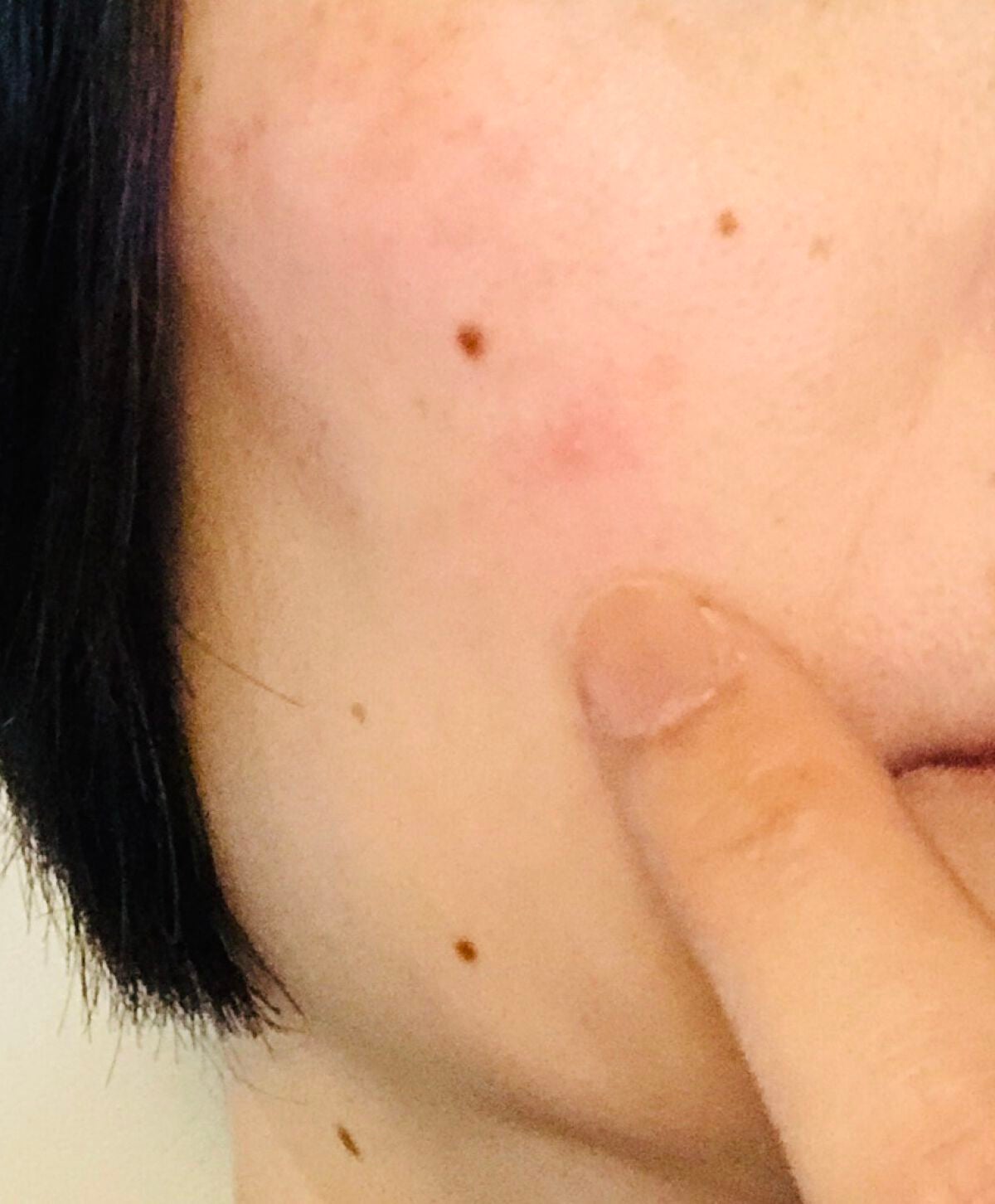 マジックティーツリーオイル/ブラン/フェイスオイルを使ったクチコミ(3枚目)