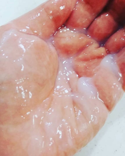 ヘッドスパセブン トリートメント/ヘッドスパセブン/頭皮トリートメントを使ったクチコミ(4枚目)