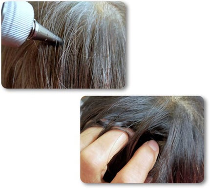 ナノグロウリッチ/iqumore/頭皮ローションを使ったクチコミ(2枚目)