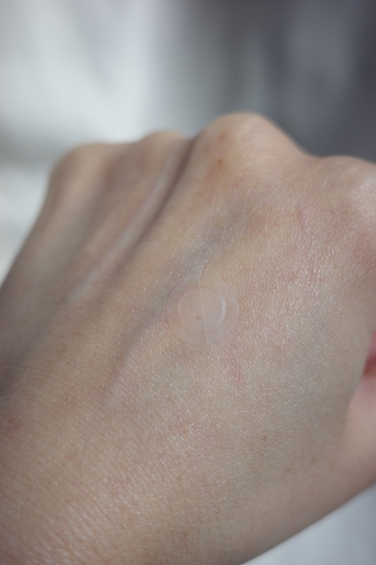 ミラクルクリアスージングスポットジェル/Rael/にきびパッチを使ったクチコミ(4枚目)