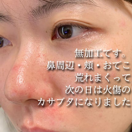 ノーモアブラックヘッド(ノーズピーリング)/One-day's you/スクラブ・ゴマージュを使ったクチコミ(3枚目)