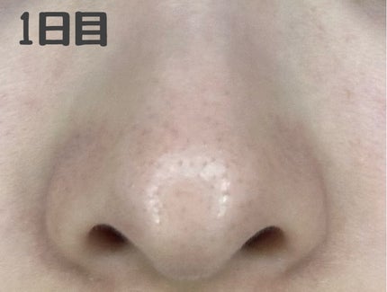 ビタペアC 集中美容液スペシャルセット/ネイチャーリパブリック/美容液を使ったクチコミ(2枚目)