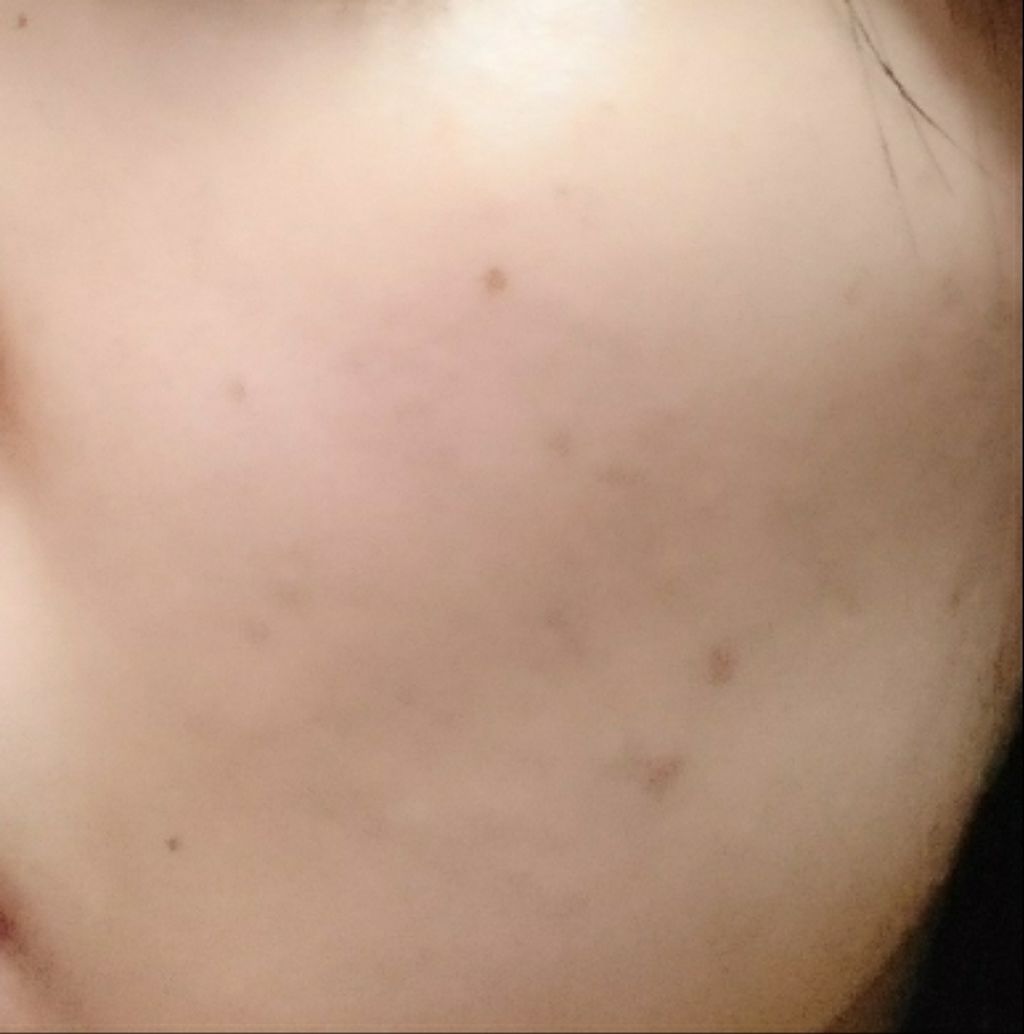 フォーエバー リブレイター エッセンス ローション/YVES SAINT LAURENT BEAUTE/化粧水を使ったクチコミ（2枚目）