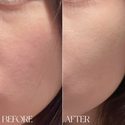 ロングラスティングチップコンシーラー/LUNA/リキッドコンシーラーを使ったクチコミ(6枚目)