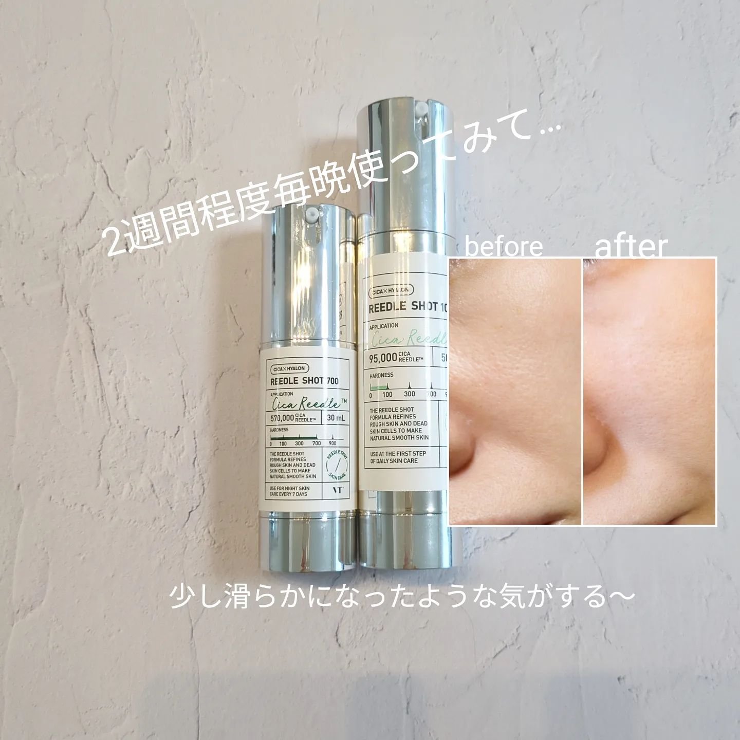 リードルショット100/VT/美容液を使ったクチコミ（3枚目）